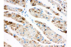Anti- CPT1B Picoband antibody, IHC(P) IHC(P): Rat Cardiac Muscle Tissue (CPT1B anticorps  (N-Term))