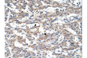 Immunohistochemistry (IHC) image for anti-Deoxyuridine Triphosphatase (DUT) (N-Term) antibody (ABIN2782437)