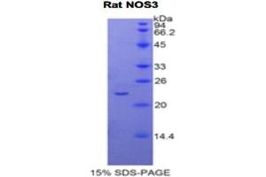 SDS-PAGE analysis of Rat NOS3 Protein. (ENOS Protéine)