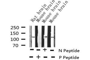 Western blot analysis of Phospho-Retinoblastoma (Ser807) expression in various lysates (Retinoblastoma 1 anticorps  (pSer807))