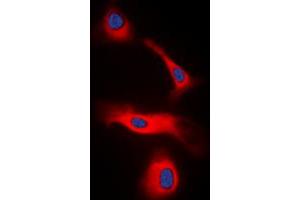 Immunofluorescent analysis of LT beta staining in HeLa cells. (LTB anticorps  (C-Term))