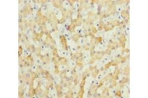 Immunohistochemistry of paraffin-embedded human liver tissue using ABIN7151803 at dilution of 1:100