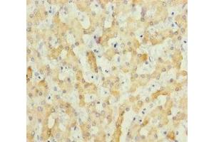 Immunohistochemistry of paraffin-embedded human liver tissue using ABIN7151803 at dilution of 1:100 (ECHS1 anticorps  (AA 28-290))