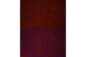 Immunofluorescence analysis of rat brain using STXBP1 antibody (ABIN6128255, ABIN6148673, ABIN6148674 and ABIN6221073) at dilution of 1:50. (STXBP1 anticorps  (AA 295-594))