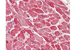 Anti-AK1 / Adenylate Kinase 1 antibody IHC staining of human heart.