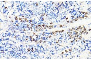 Immunohistochemistry of paraffin-embedded Rat spleen using S100A9 Polyclonal Antibody at dilution of 1:100 (40x lens).