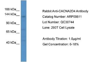 WB Suggested Anti-CACNA2D4  Antibody Titration: 0. (CACNA2D4 anticorps  (C-Term))