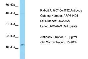 Western Blotting (WB) image for anti-Golgin A7 Family, Member B (GOLGA7B) (N-Term) antibody (ABIN2785697) (GOLGA7B anticorps  (N-Term))