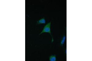 IF analysis of TIMM17A using anti-TIMM17A antibody (ABIN6719637).