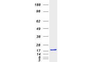 Validation with Western Blot