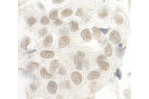 Immunohistochemistry (IHC) image for anti-Forkhead Box P1 (FOXP1) (AA 627-677) antibody (ABIN7448572) (FOXP1 anticorps  (AA 627-677))
