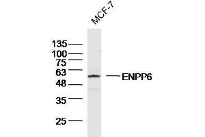 MCF-7 Cell lysates probed with ENPP6 Polyclonal Antibody, unconjugated (bs-13076R) at 1:300 overnight at 4°C followed by a conjugated secondary antibody for 60 minutes at 37°C.