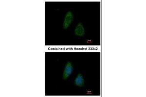 ICC/IF Image Immunofluorescence analysis of methanol-fixed HeLa, using BMP4, antibody at 1:200 dilution. (BMP4 anticorps  (C-Term))