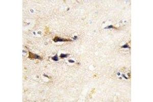 IHC analysis of FFPE human brain tissue stained with BACE1 antibody