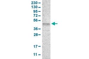Western Blot analysis of human cell line RT-4 with PRKX polyclonal antibody . (PRKX anticorps  (AA 267-342))