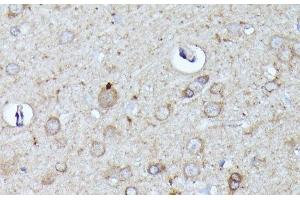 Immunohistochemistry of paraffin-embedded Rat brain using N-WASP Polyclonal Antibody at dilution of 1:100 (40x lens). (Neural Wiskott-Aldrich syndrome protein (WASL) anticorps)