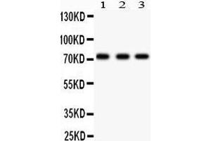 Anti- p73 antibody, Western blotting All lanes: Anti p73  at 0.
