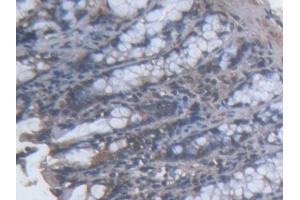 DAB staining on IHC-P; Samples: Mouse Colon Tissue (TOPBP1 anticorps  (AA 1-246))