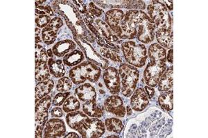 Immunohistochemical staining of human kidney with IFT80 polyclonal antibody  shows strong cytoplasmic positivity with a granular pattern in cells in tubules at 1:50-1:200 dilution.