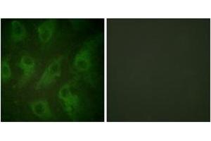 Immunofluorescence analysis of HeLa cells, using Kir6. (KCNJ11 anticorps  (AA 190-239))