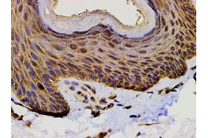 ABIN6267452 at 1/200 staining human skin tissue sections by IHC-P.