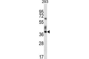 Western Blotting (WB) image for anti-Olfactory Receptor, Family 9, Subfamily K, Member 2 (OR9K2) antibody (ABIN2996627) (OR9K2 anticorps)