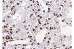 ABIN6267014 at 1/100 staining human kidney tissue sections by IHC-P. (CTBP1 anticorps  (pSer422))
