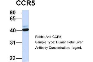 Host: Rabbit Target Name: CCR5 Sample Type: Human Fetal Liver Antibody Dilution: 1. (CCR5 anticorps  (Middle Region))