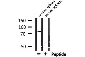 Western blot analysis of extracts from mouse spleen, using ZYX  Antibody. (ZYX anticorps  (Internal Region))