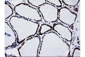 Image no. 8 for anti-Bridging Integrator 3 (BIN3) antibody (ABIN1496923)