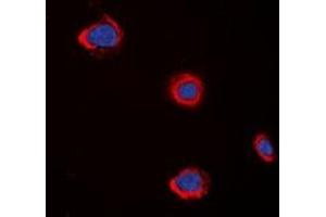Immunofluorescent analysis of CHRM5 staining in A549 cells. (CHRM5 anticorps)