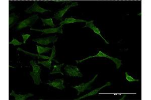 Immunofluorescence of monoclonal antibody to CD55 on HeLa cell.