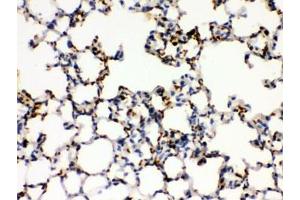 IHC testing of FFPE mouse lung with CD41 antibody. (Integrin Alpha2b anticorps)