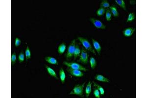 Immunofluorescent analysis of A549 cells using ABIN7172859 at dilution of 1:100 and Alexa Fluor 488-congugated AffiniPure Goat Anti-Rabbit IgG(H+L)