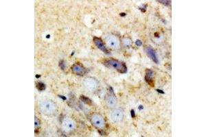 Immunohistochemical analysis of Complement C1QA staining in mouse brain formalin fixed paraffin embedded tissue section. (C1QA anticorps)