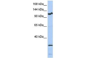WB Suggested Anti-OSMR Antibody Titration:  0. (Oncostatin M Receptor anticorps  (Middle Region))