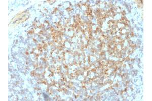 Formalin-fixed, paraffin-embedded human Tonsil stained with CD61 Mouse Monoclonal Antibody (ITGB3/2145). (Integrin beta 3 anticorps  (AA 385-490))