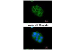 ICC/IF Image Immunofluorescence analysis of paraformaldehyde-fixed A431, using cylindromatosis 1, antibody at 1:200 dilution.