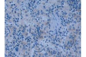 Detection of NOS2 in Rat Spleen Tissue using Polyclonal Antibody to Nitric Oxide Synthase 2, Inducible (NOS2)