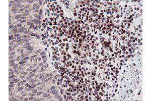Image no. 2 for anti-Myocyte Enhancer Factor 2C (MEF2C) antibody (ABIN1499366)