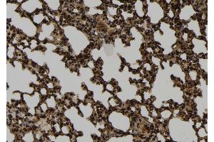 ABIN6274040 at 1/100 staining Mouse lung tissue by IHC-P.