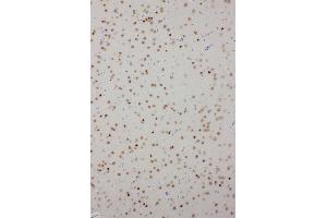 Anti-PDK2 antibody, IHC(P) IHC(P): Rat Brain Tissue