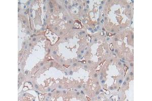 Used in DAB staining on fromalin fixed paraffin- embedded kidney tissue