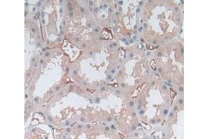 Used in DAB staining on fromalin fixed paraffin- embedded kidney tissue (MPP2 anticorps  (AA 345-573))