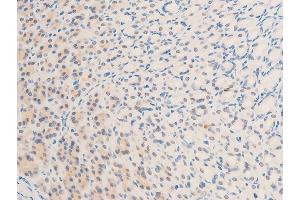 ABIN6267234 at 1/100 staining rat gastric tissue sections by IHC-P.