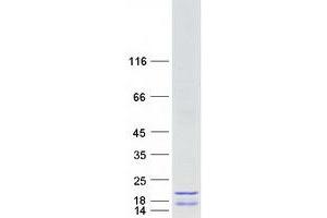 Validation with Western Blot