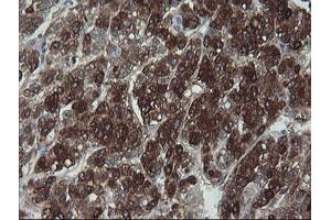 Immunohistochemistry (IHC) image for anti-Formiminotransferase Cyclodeaminase (FTCD) antibody (ABIN1496377)