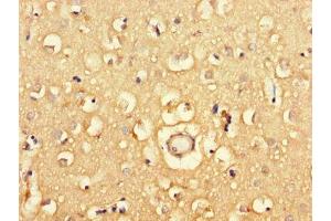 Immunohistochemistry of paraffin-embedded human brain tissue using ABIN7163908 at dilution of 1:100 (Pgap2 anticorps  (AA 45-114))