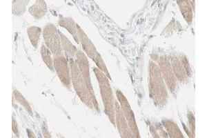 ABIN6266729 at 1/100 staining human Skeletal muscle tissue sections by IHC-P. (NDUFC2 anticorps  (C-Term))