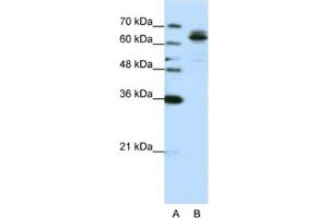 Western Blotting (WB) image for anti-Fragile X Mental Retardation, Autosomal Homolog 1 (FXR1) antibody (ABIN2462084) (FXR1 anticorps)